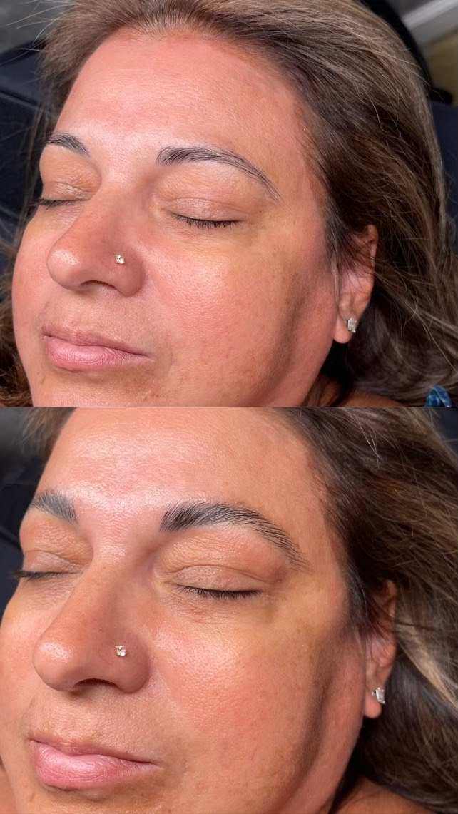 brow lamination before and after